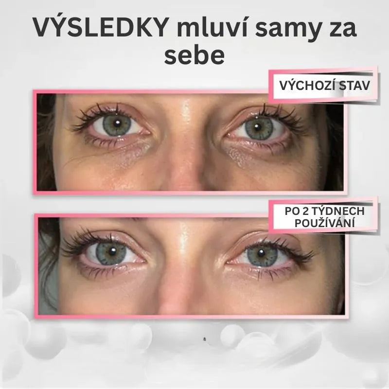Terapia LED przeciwzmarszczkowa pod oczy – YUMA RevitalEyes